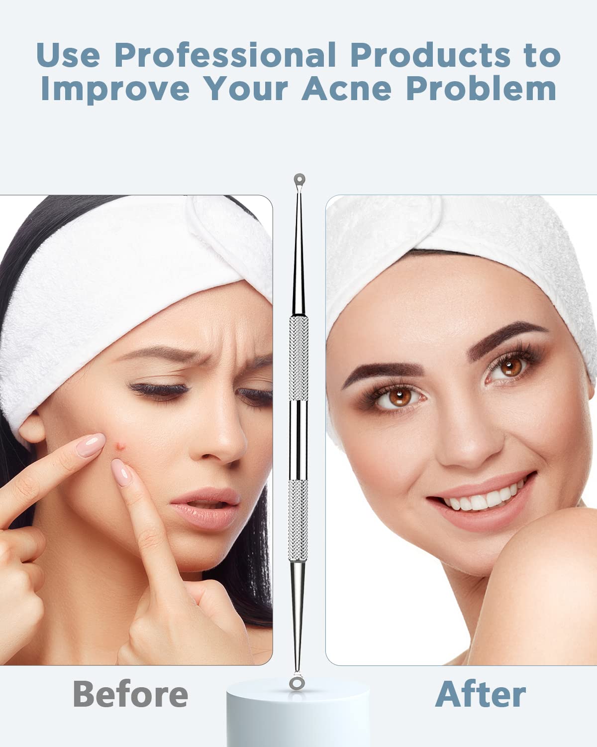 TAYTHI Blackhead Remover Tool, Pimple Popper Tool Kit, Blackhead Extractor tool for Face, Extractor Tool for Comedone Zit Acne Whitehead Blemish, Stainless Steel Extraction tools-1